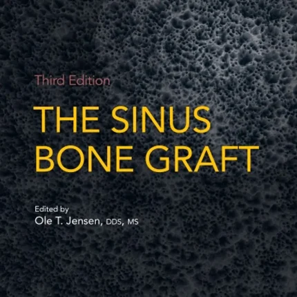 The Sinus Bone Graft