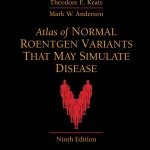 Atlas of Normal Roentgen Variants That May Simulate Disease