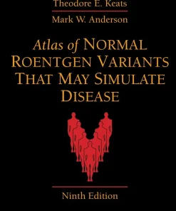 Atlas of Normal Roentgen Variants That May Simulate Disease