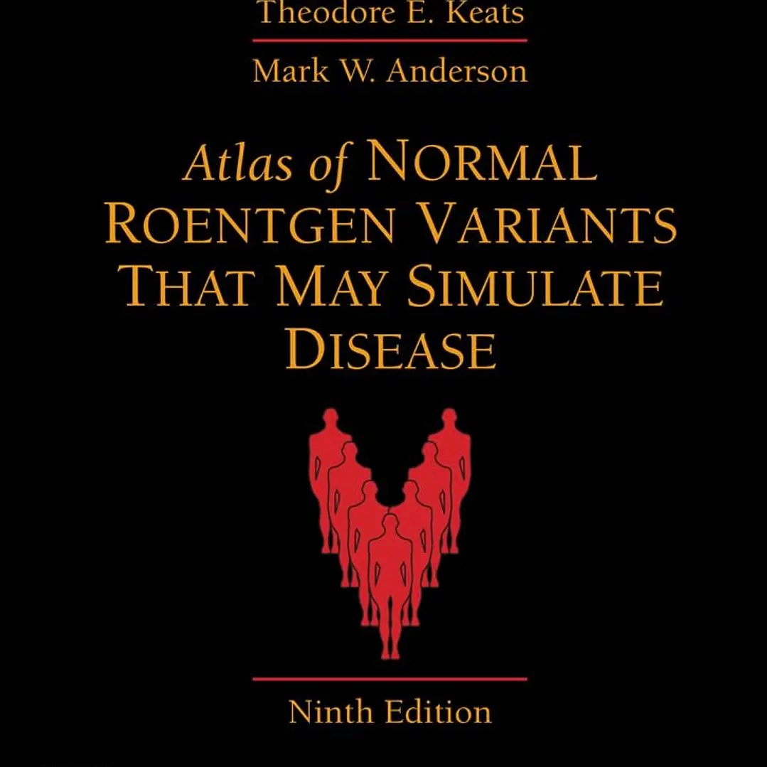 Atlas of Normal Roentgen Variants That May Simulate Disease