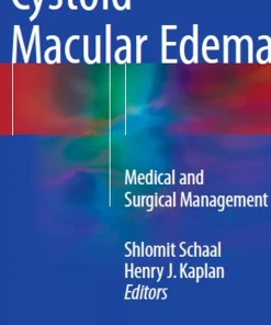Cystoid Macular Edema Medical and Surgical Management