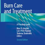 Burn Care and Treatment A Practical Guide
