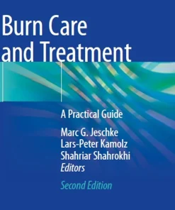 Burn Care and Treatment A Practical Guide