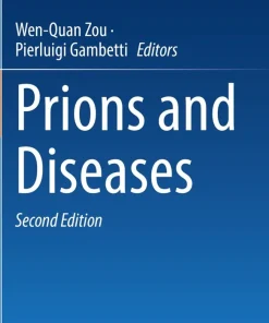 Prions and Diseases