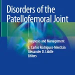 Disorders of the Patellofemoral Joint Diagnosis and Management