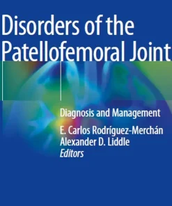 Disorders of the Patellofemoral Joint Diagnosis and Management