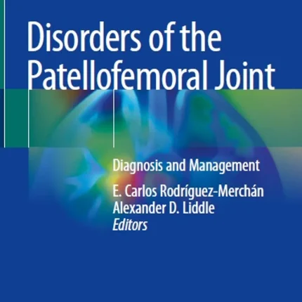 Disorders of the Patellofemoral Joint Diagnosis and Management