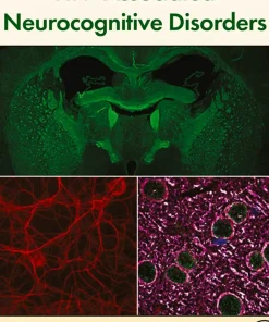 HIV-Associated Neurocognitive Disorders
