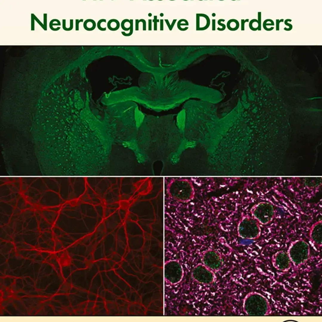 HIV-Associated Neurocognitive Disorders