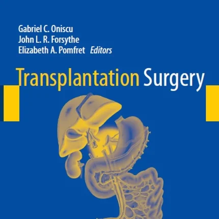 Transplantation Surgery