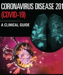Coronavirus Disease 2019 (Covid-19) A Clinica