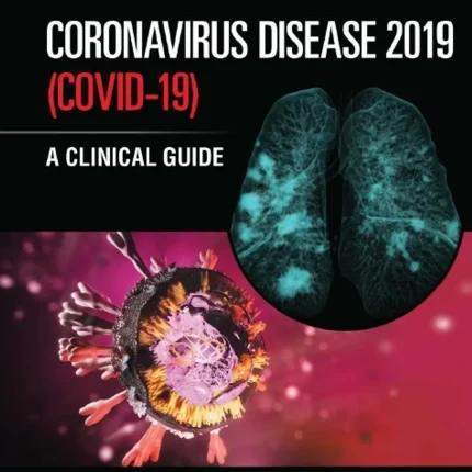 Coronavirus Disease 2019 (Covid-19) A Clinica