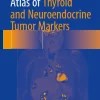 Atlas of Thyroid and Neuroendocrine Tumor Markers