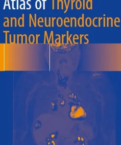 Atlas of Thyroid and Neuroendocrine Tumor Markers