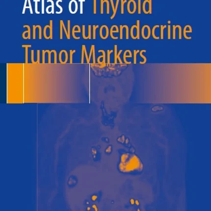 Atlas of Thyroid and Neuroendocrine Tumor Markers