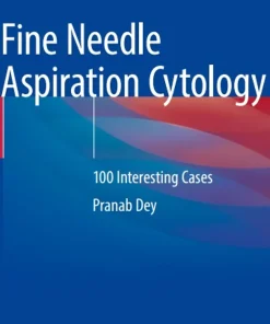 Fine Needle Aspiration Cytology 100 Interesting Cases