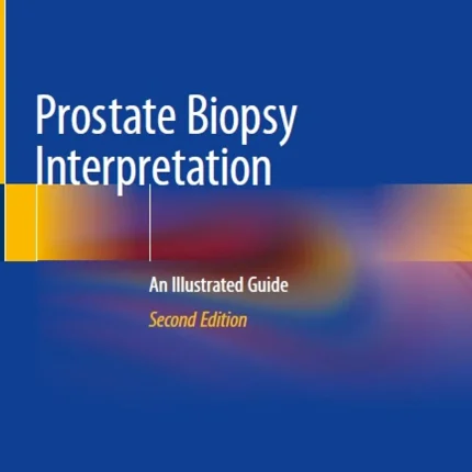 Prostate Biopsy Interpretation An Illustrated Guide