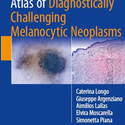 Atlas of Diagnostically Challenging Melanocytic Neoplasms