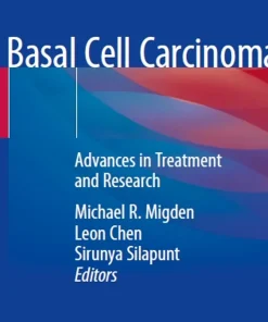 Basal Cell Carcinoma Advances in Treatment and Research