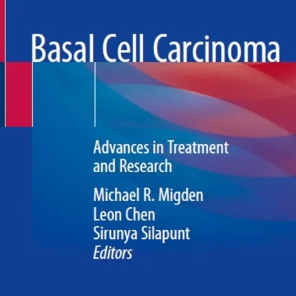 Basal Cell Carcinoma Advances in Treatment and Research