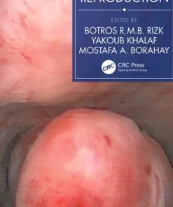 Fibroids and Reproduction