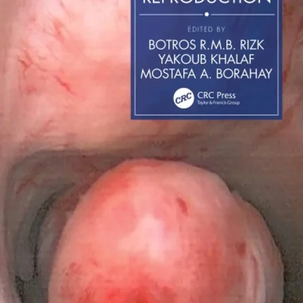 Fibroids and Reproduction