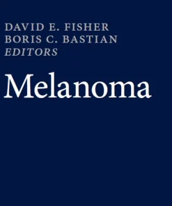 Melanoma