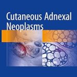 Cutaneous Adnexal Neoplasms