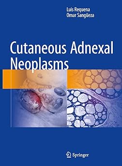 Cutaneous Adnexal Neoplasms