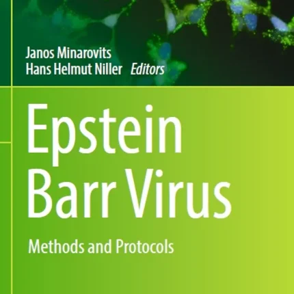 Epstein Barr Virus Methods and Protocols