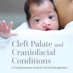 Cleft Palate And Craniofacial Conditions
