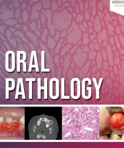 Oral Pathology
