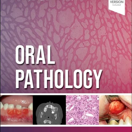 Oral Pathology