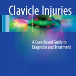 Clavicle Injuries