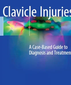 Clavicle Injuries