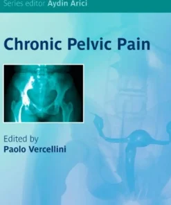 Chronic Pelvic Pain