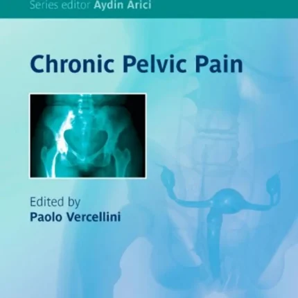 Chronic Pelvic Pain