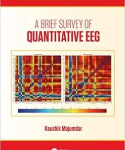 A Brief Survey of Quantitative EEG