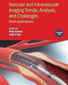 Vascular and Intravascular Imaging Trends Analysis and Challenges Volume 1 Stent applications
