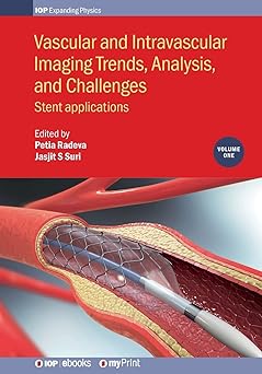 Vascular and Intravascular Imaging Trends Analysis and Challenges Volume 1 Stent applications
