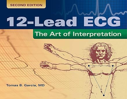 12-Lead ECG The Art Of Interpretation