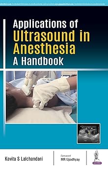 Applications of Ultrasound in Anesthesia A Handbook