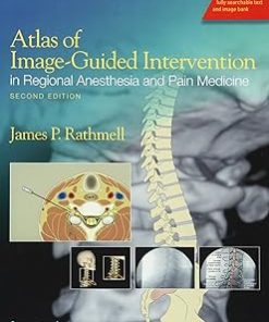 Atlas of Image-Guided Intervention in Regional Anesthesia and Pain Medicine