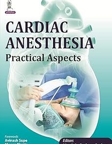Cardiac Anesthesia Practical Aspects