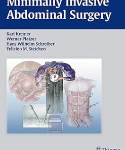 Minimally Invasive Abdominal Surgery Laparascopic and Thoracic Surgery