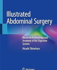 Illustrated Abdominal Surgery