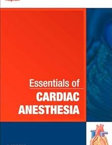 Essentials of Cardiac Anesthesia