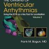 The Origins of Ventricular Arrhythmias Volume 2