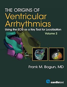The Origins of Ventricular Arrhythmias Volume 2