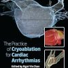 The Practice of Catheter Cryoablation for Cardiac Arrhythmias